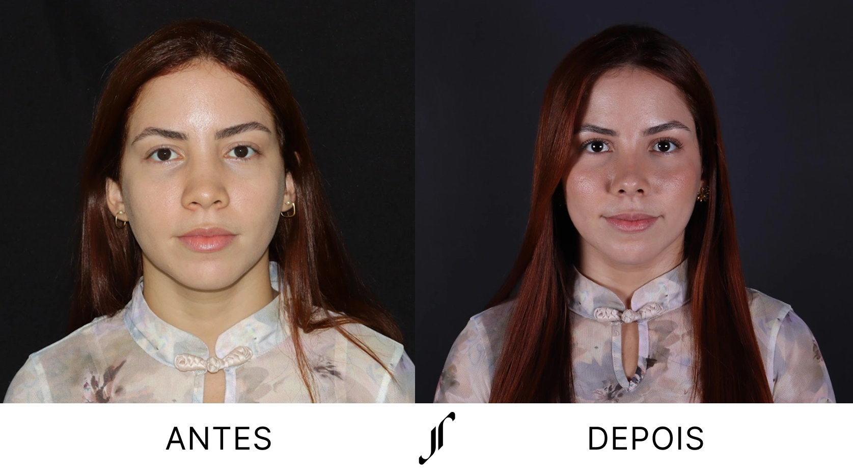 DEP 1