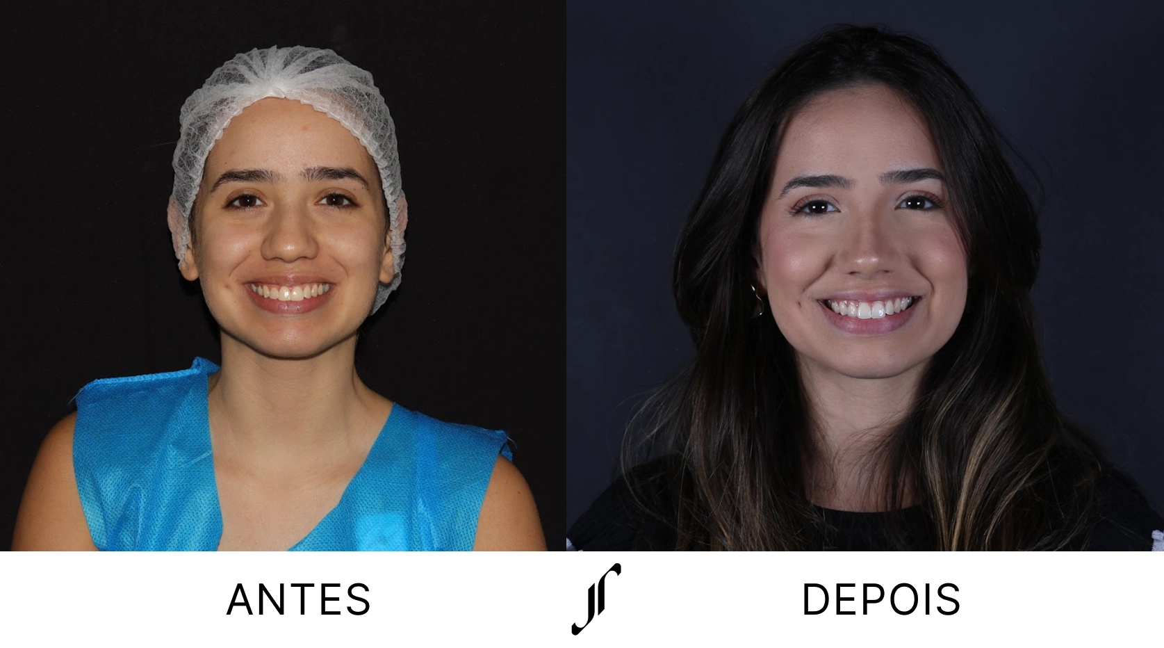 DEP 2