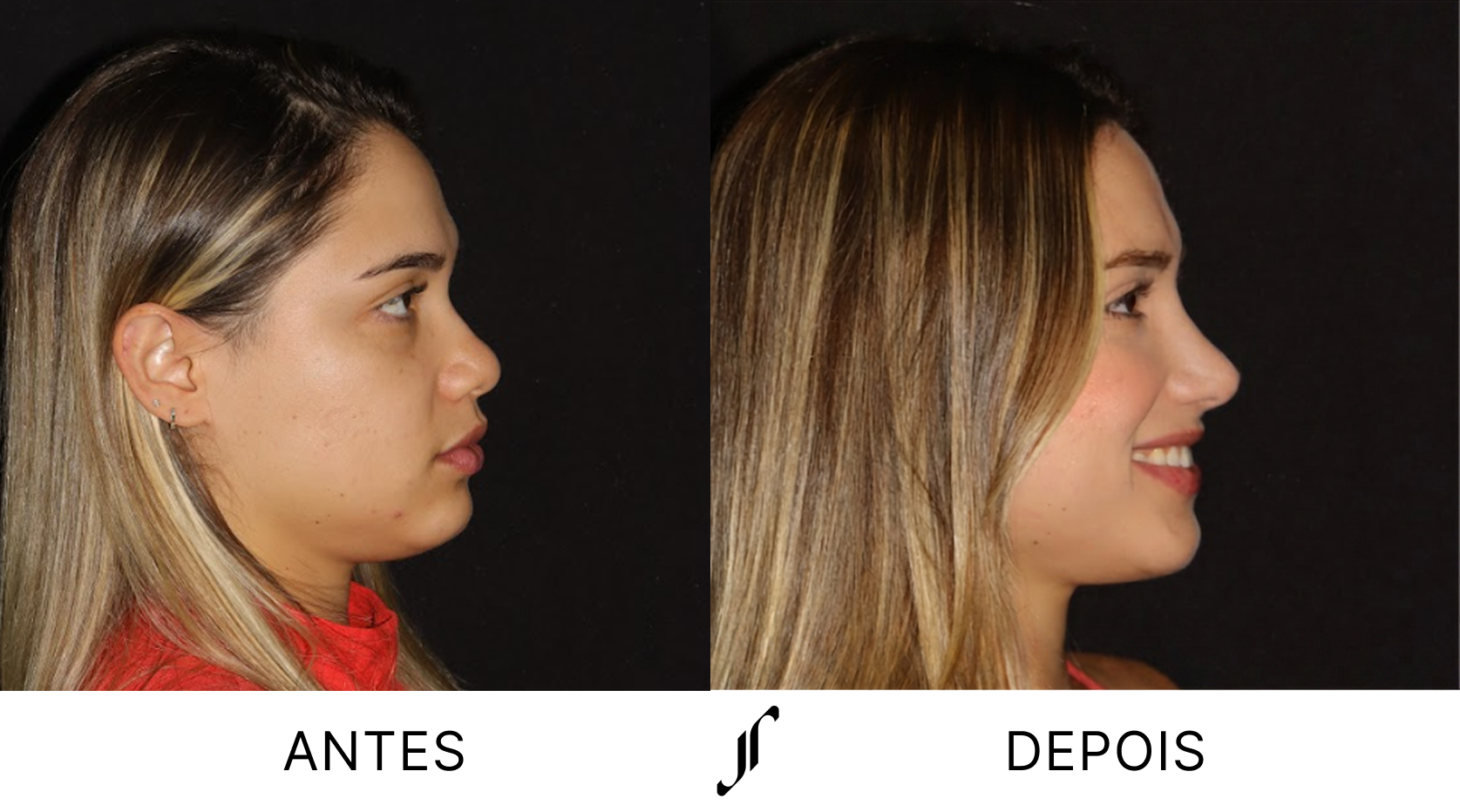 DEP 3 ponto